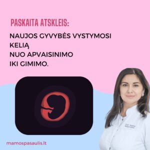 Alternative view of 280 dienų iki susitikimo